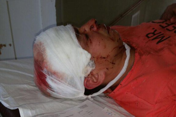 «Казнь молодогвардейца» в Казани: за что побили Эдуарда Салахутдинова?