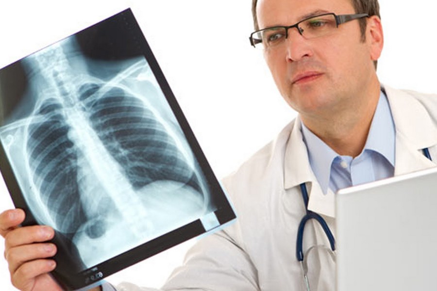 Африканского студента Казанского медуниверситета, у которого нашли туберкулез, отправляют лечиться домой