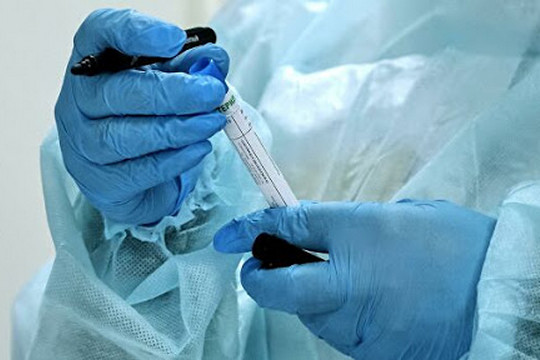 «Не есть, не пить, зубы не чистить»: в Казани начали платно тестировать на коронавирус