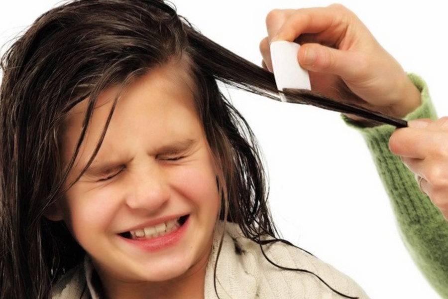 Проверка на вшивость: в Татарстане растет заболеваемость педикулезом