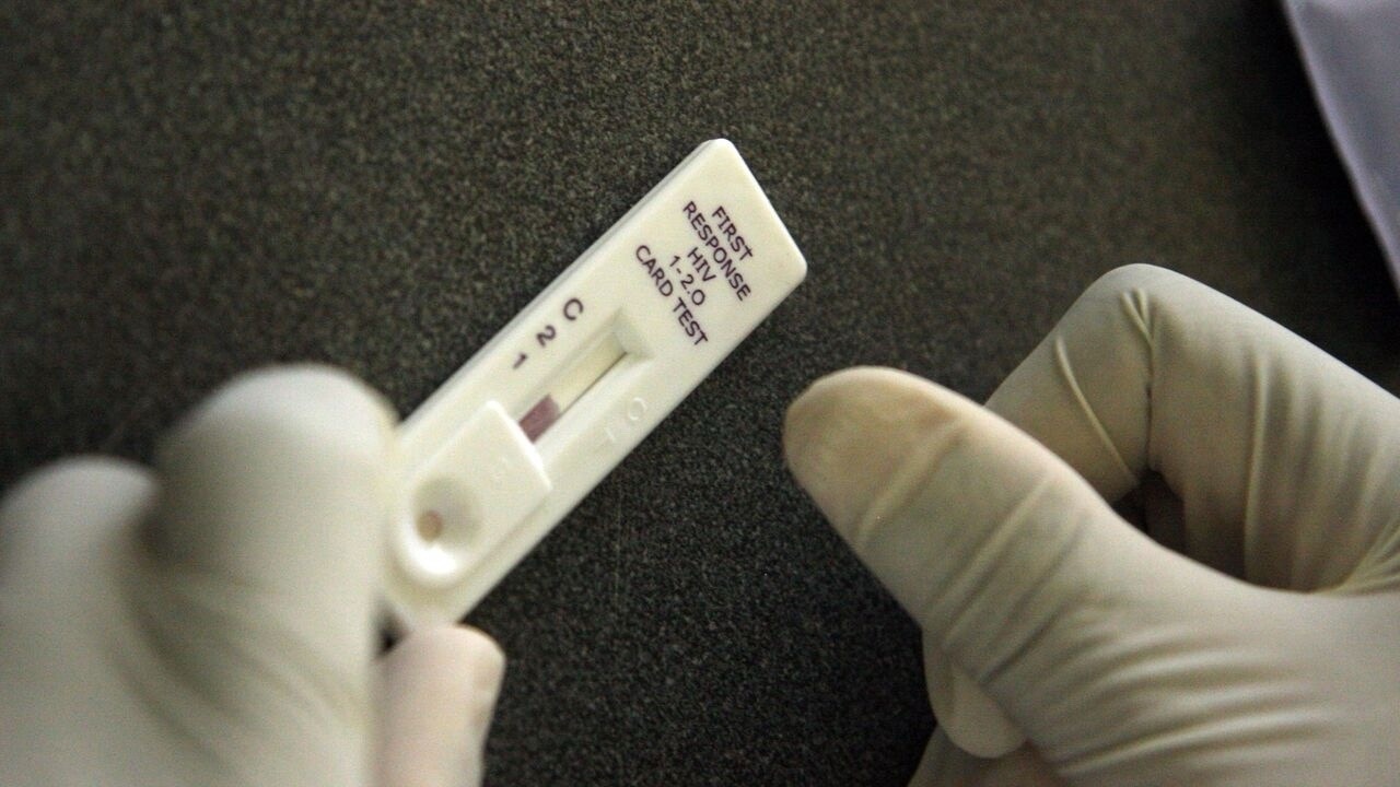 Казанцев проверят на ВИЧ в парке Горького