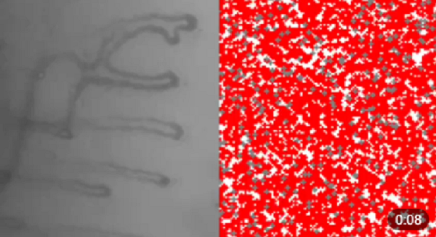 Ученые Иннополиса обучают ИИ определению содержания лейкоцитов в крови