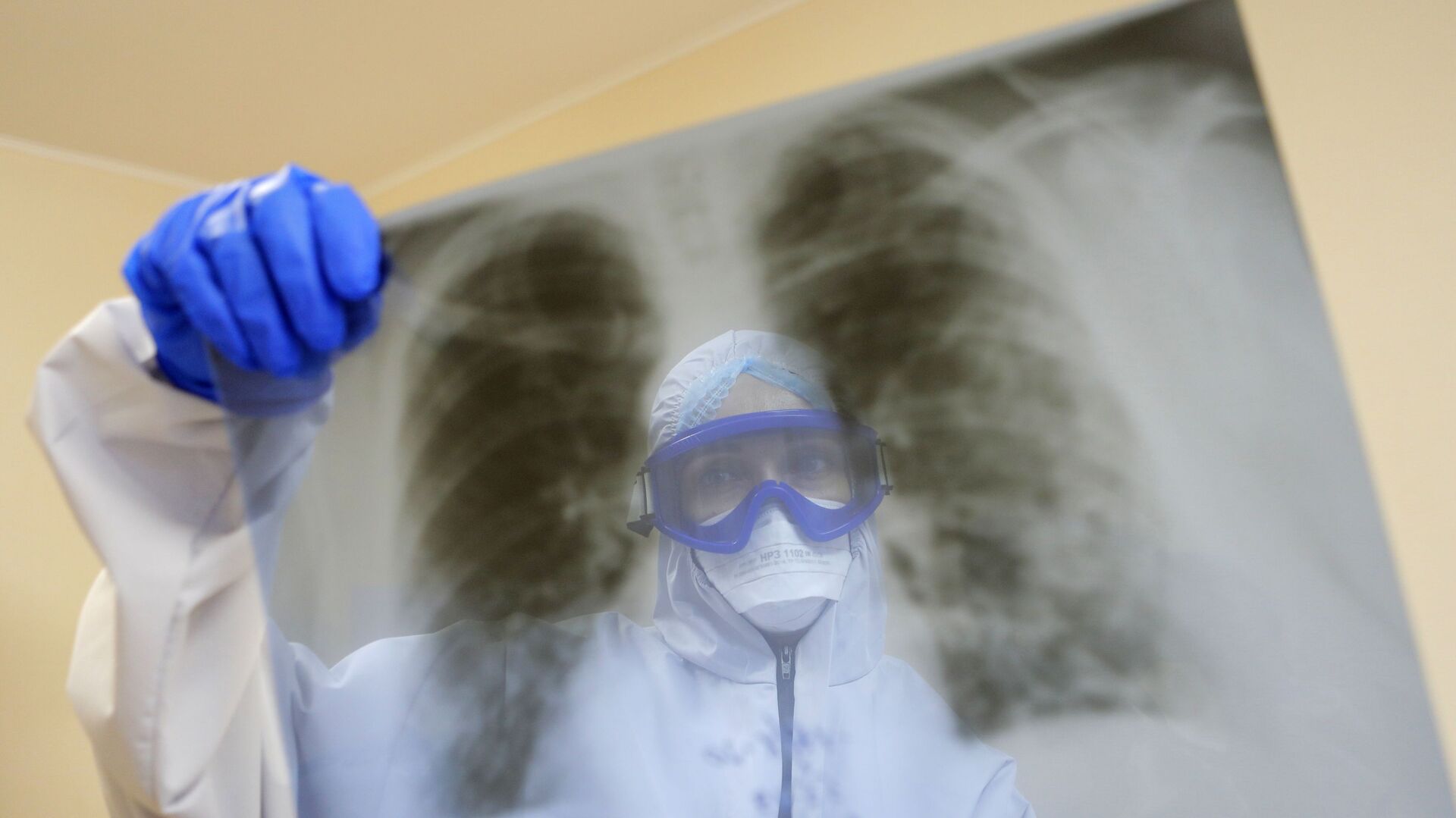 Роспотребнадзор оценил эпидситуацию по туберкулезу в Херсонской области