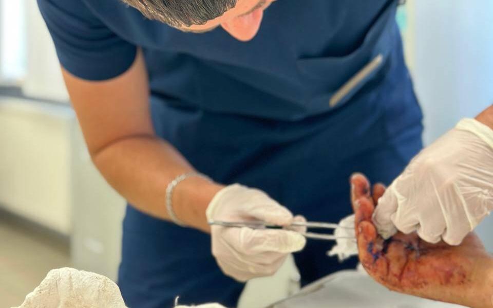 Врачи в Казани спасли пальцы мужчине, которому их отрезало деталью на работе