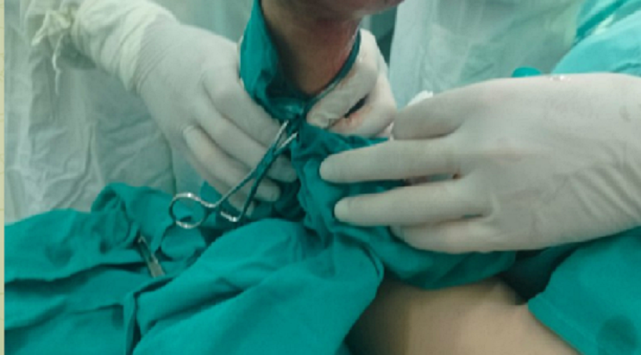 Татарстанские врачи восстановили ткани ампутированного пальца пациента