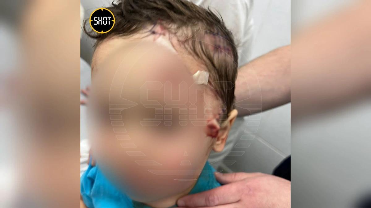 Отца мальчика, покусанного пантерой в цирке, хотят лишить родительских прав