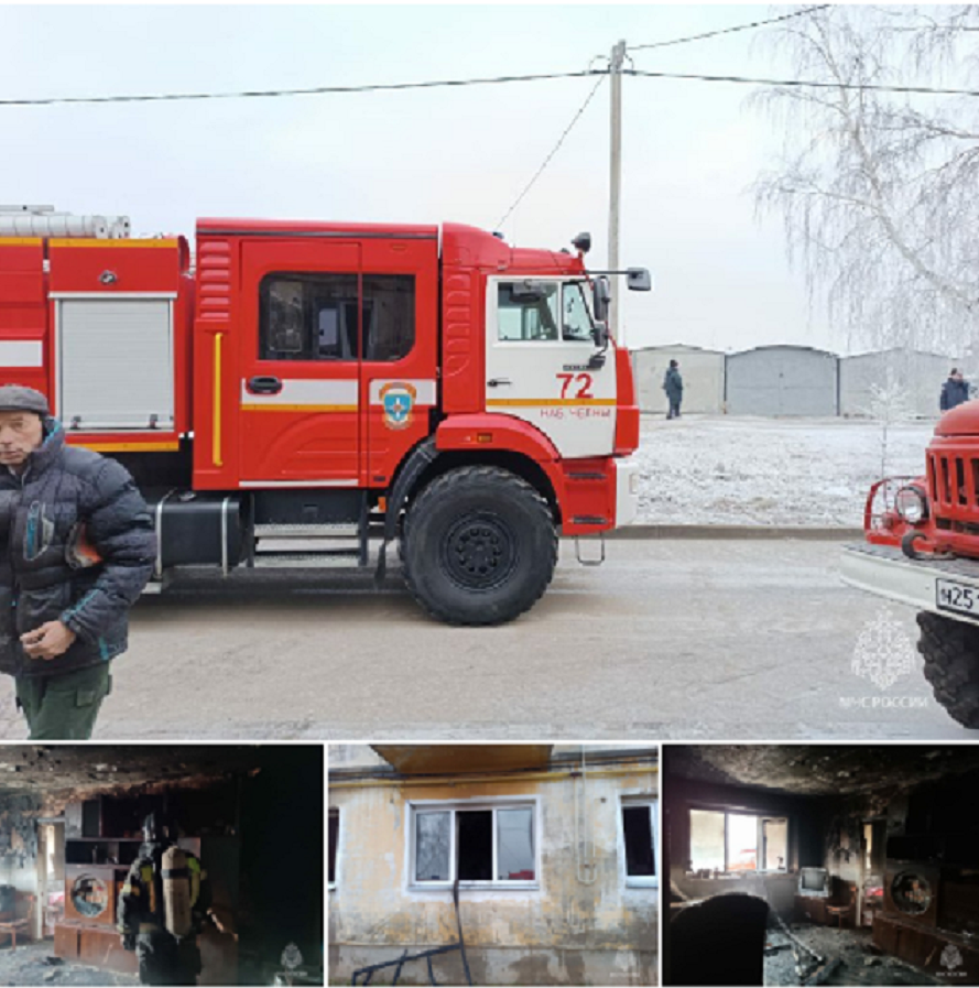 На пожаре в Тукаевском районе пенсионерка получила ожоги