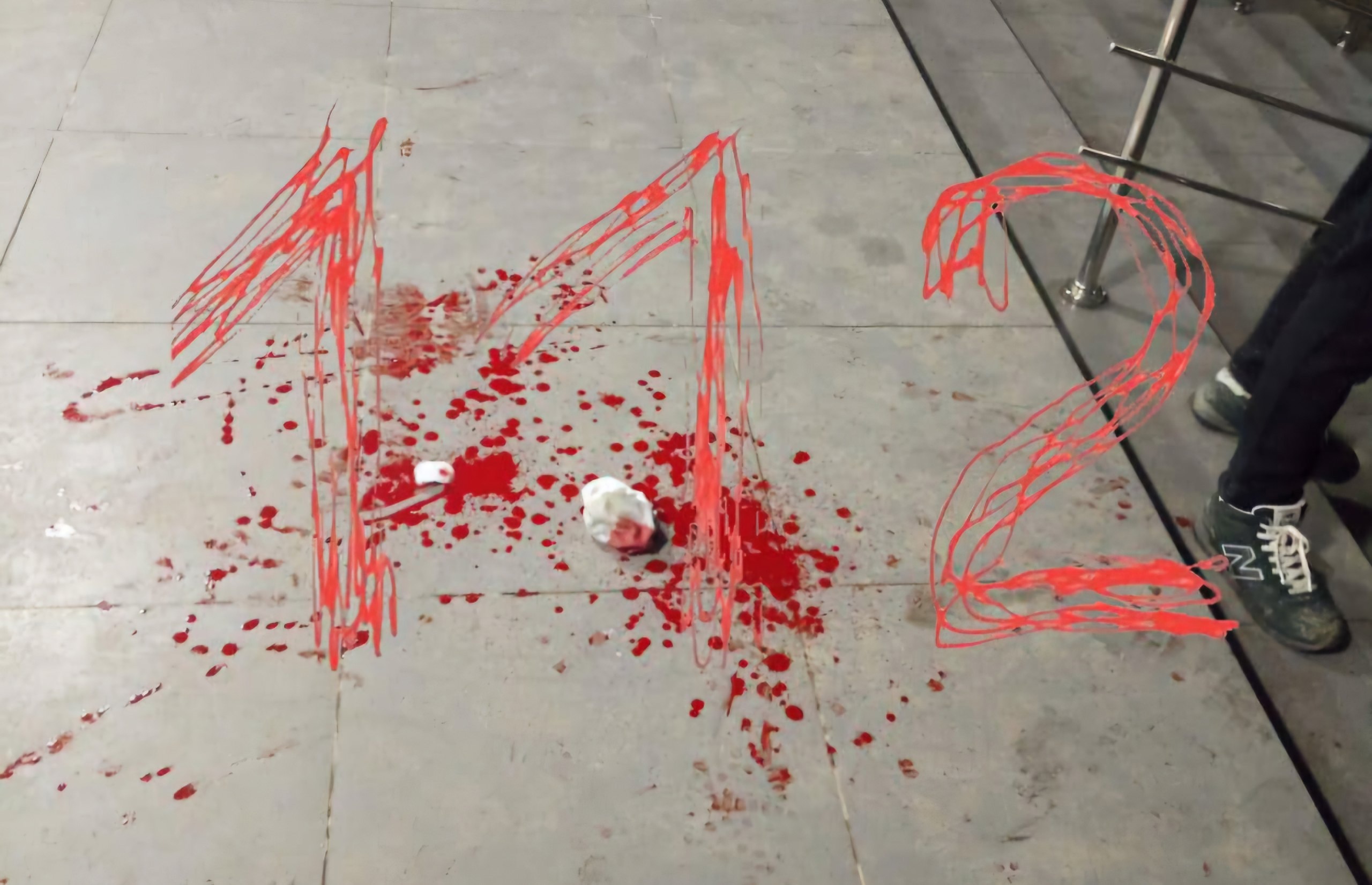 Появились подробности об учениках, которых порезал ножом школьник в Краснодаре