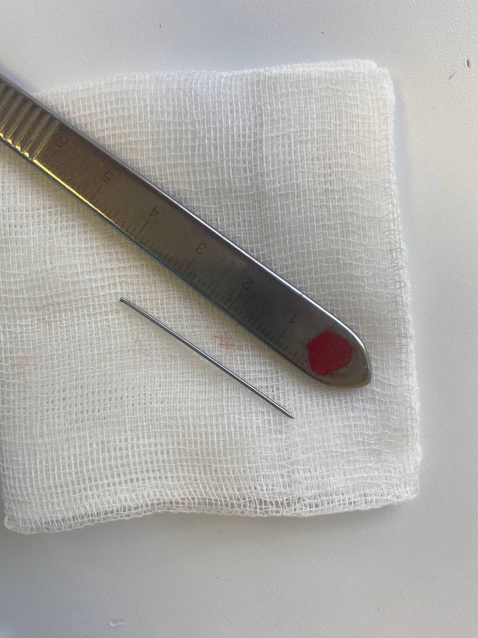 В казанской ДРКБ ребенку удалили иглу из печени