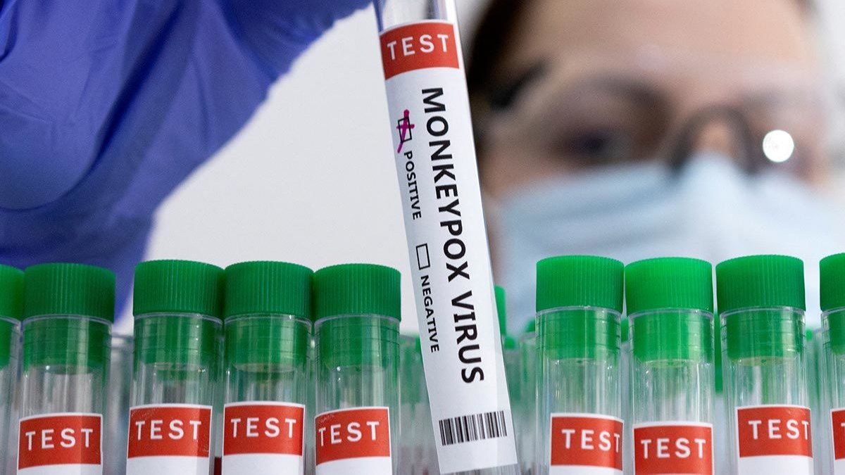 Ученый Гинцбург предупредил об угрозе массового заражения оспой обезьян