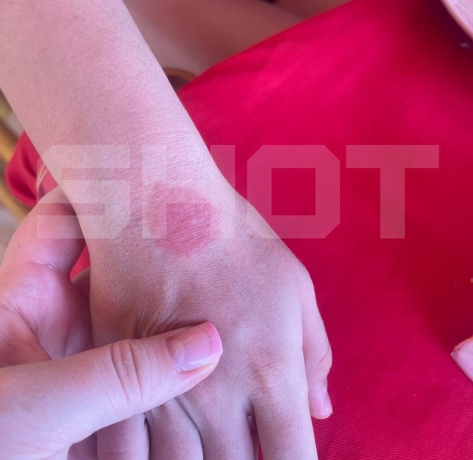 В АТОР опровергли заражение россиян лихорадкой денге во Вьетнаме