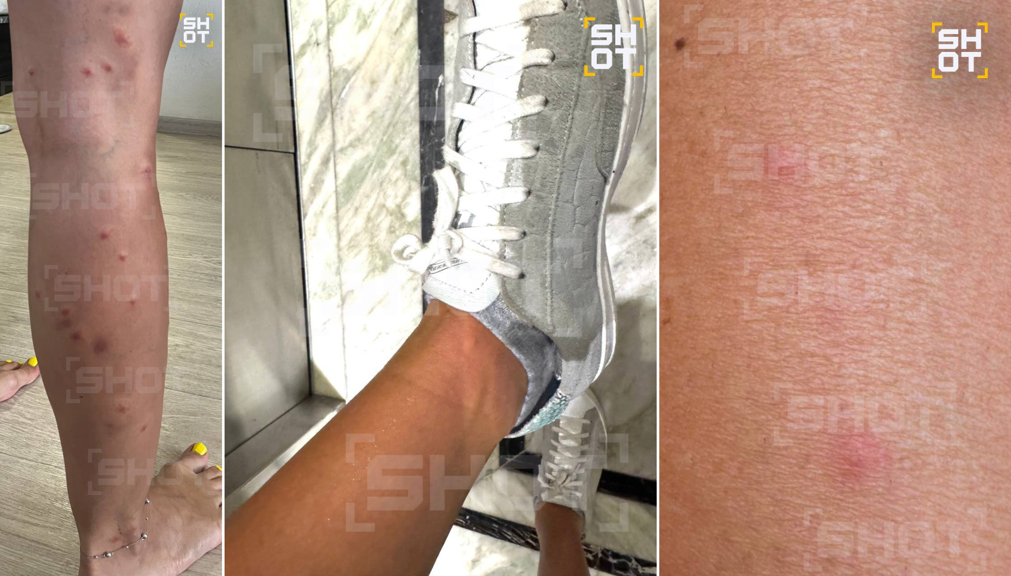 Песчаные блохи атакуют российских туристов на пляжах Китая