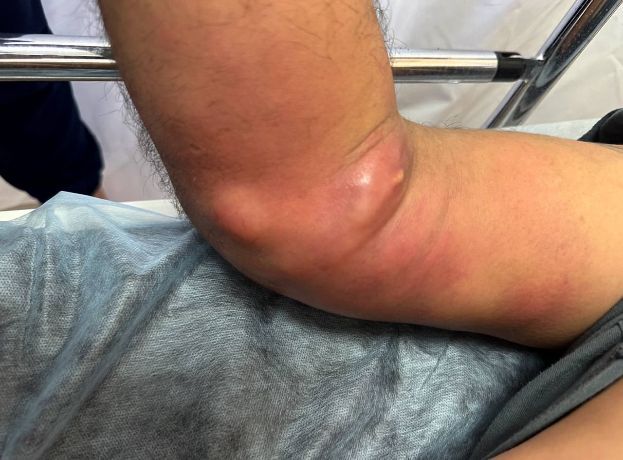 Врачи Казани спасли иностранца, пытавшегося покончить с собой из-за смерти семьи