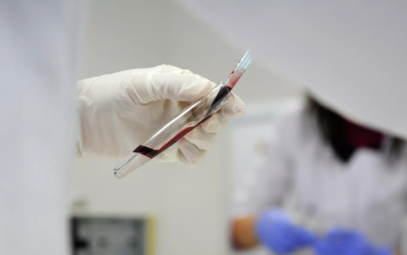 Эпидимиолог Лопушов: «Развитие вируса Нипах в Татарстане тупиковое»