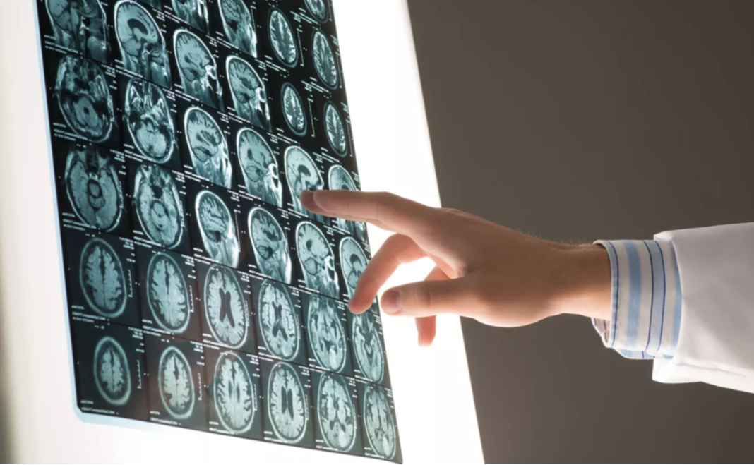 Онищенко раскрыл, когда начинает стареть мозг человека