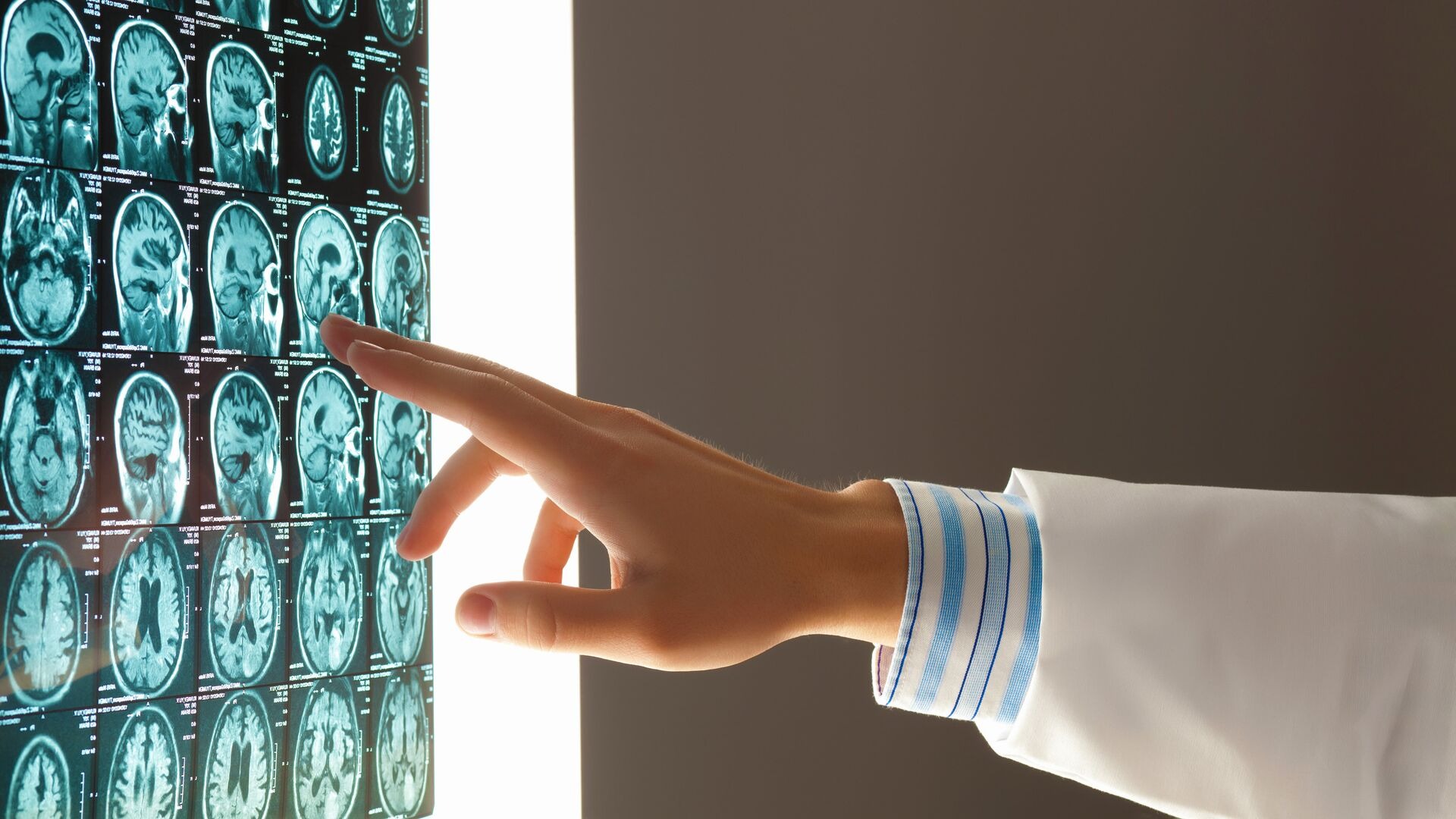 Тест-системы болезни Альцгеймера разработали в России