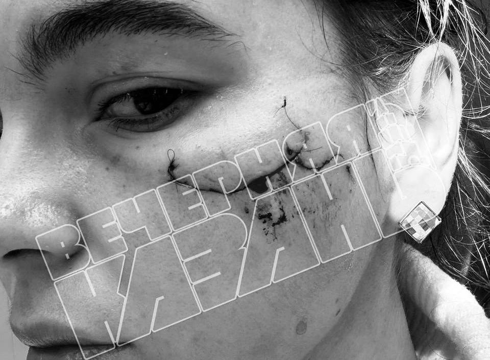 На девушку, изуродовавшую посетительницу концерта в Казани, завели дело