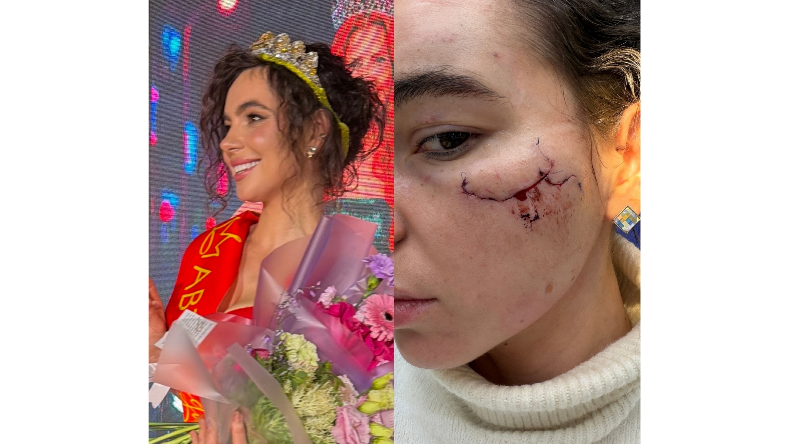 Девушку, приехавшую в Казань на концерт в «Корстоне», жестко избили в туалете