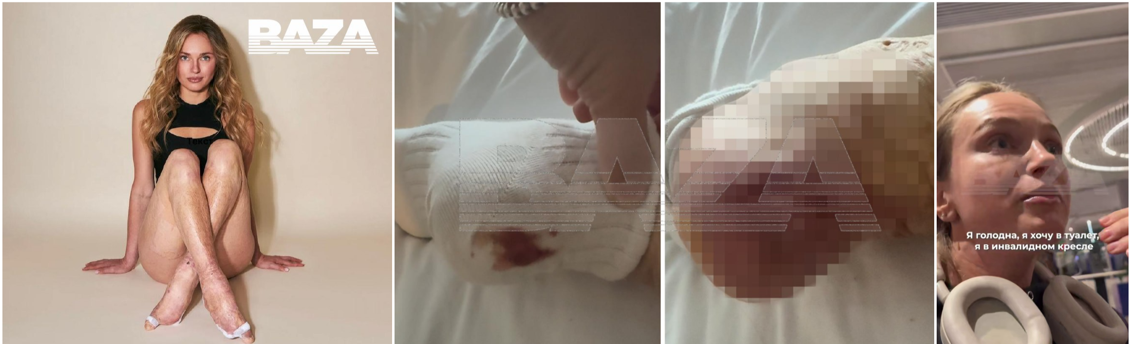 Сотрудники Turkish Airlines издевались над россиянкой с инвалидностью в Стамбуле