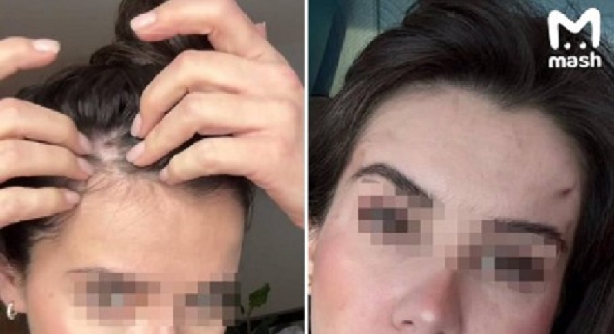 Жительница Казани требует с московского пластического хирурга 1,7 млн рублей