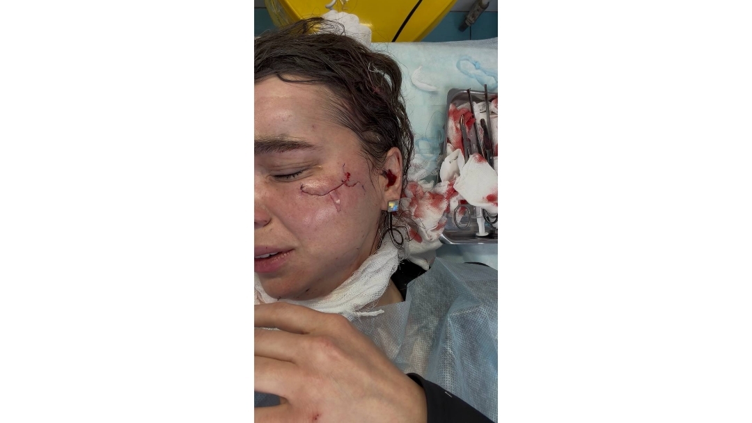 Делу по факту избиения королевы красоты в «Корстоне» Казани не дают хода