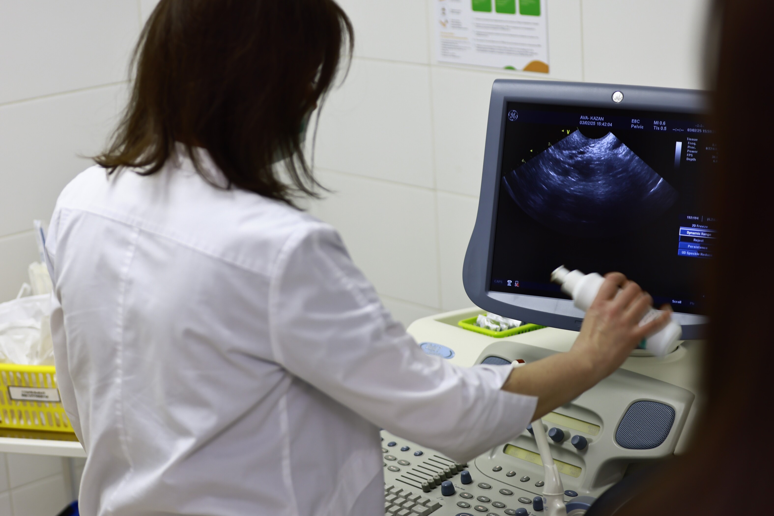 Россиянок проверят на ВПЧ и рак шейки матки на первом этапе диспансеризации