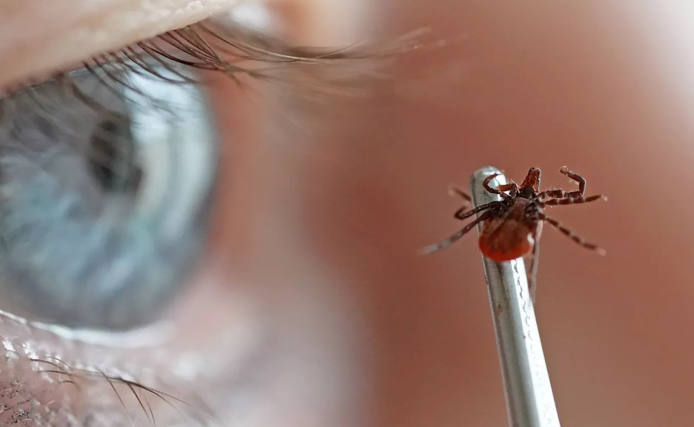 Энцефалит от клеща легко спутать с гриппом, заявил Роспотребнадзор Татарстана