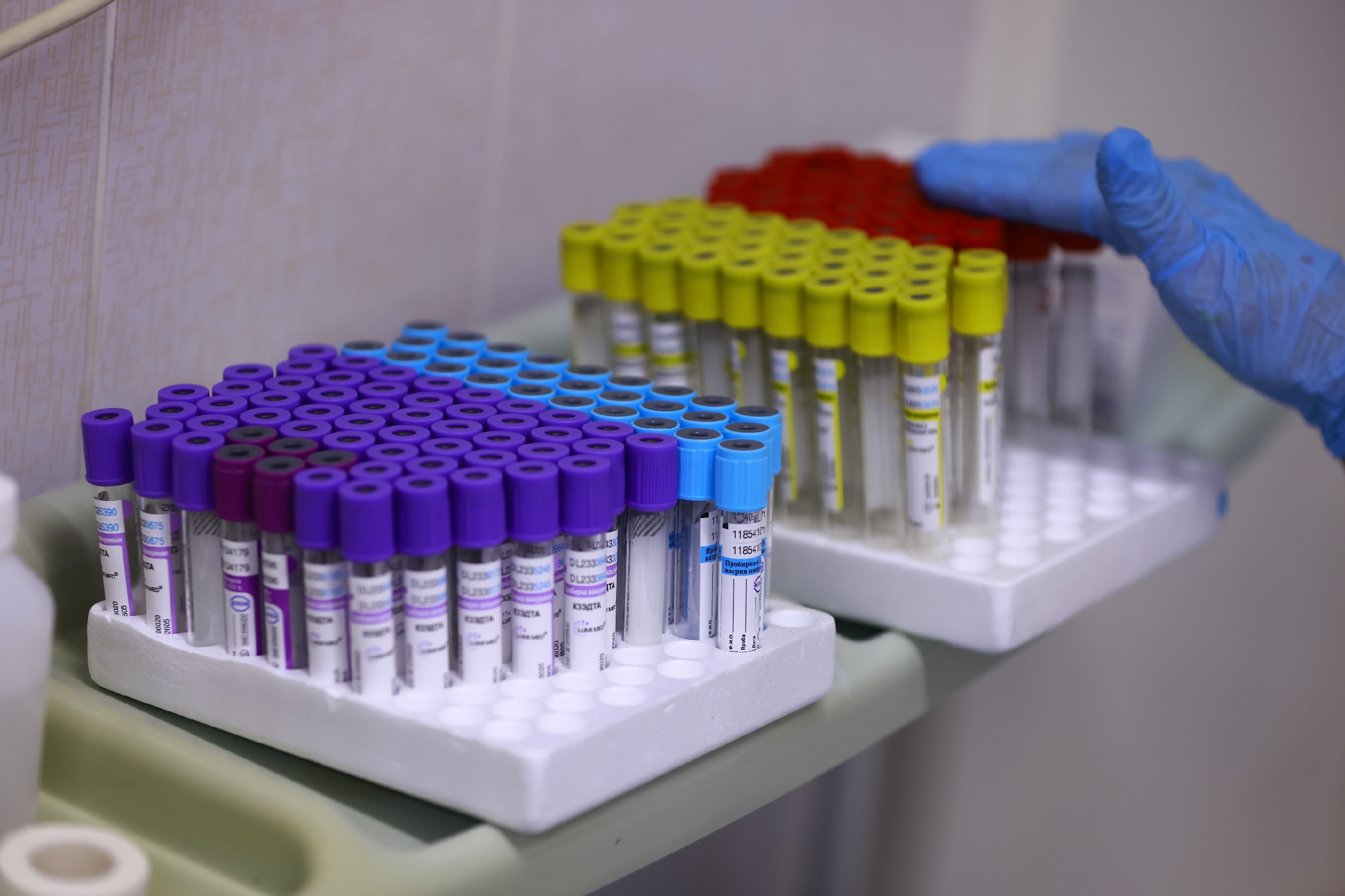 В Татарстане на профилактику ВИЧ направят 1,3 млн рублей